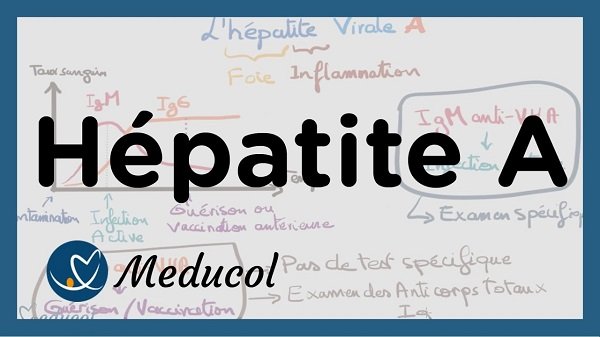 Epatite A
